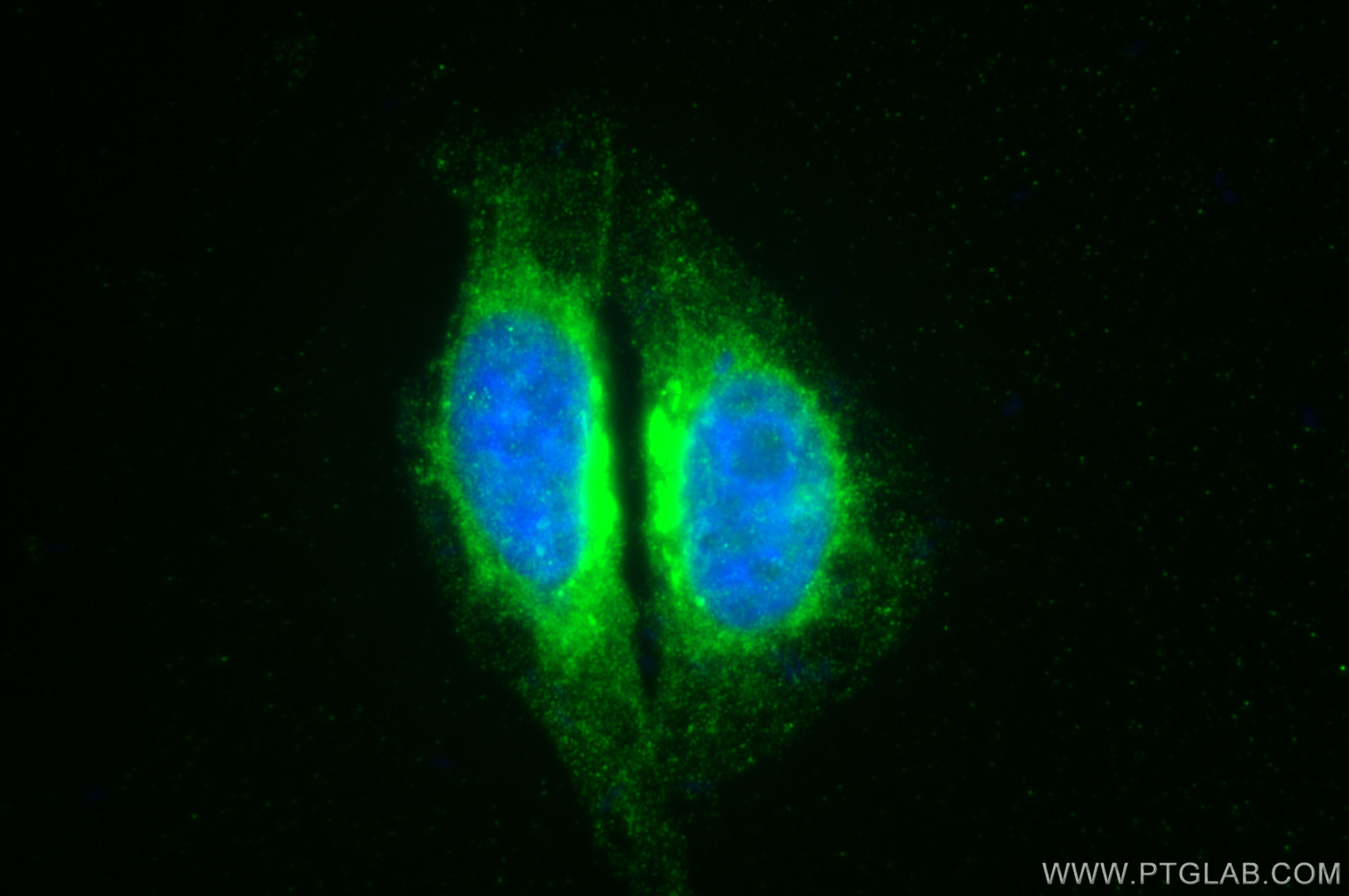 Immunofluorescence (IF) / fluorescent staining of HepG2 cells using TMEM165 Polyclonal antibody (20485-1-AP)