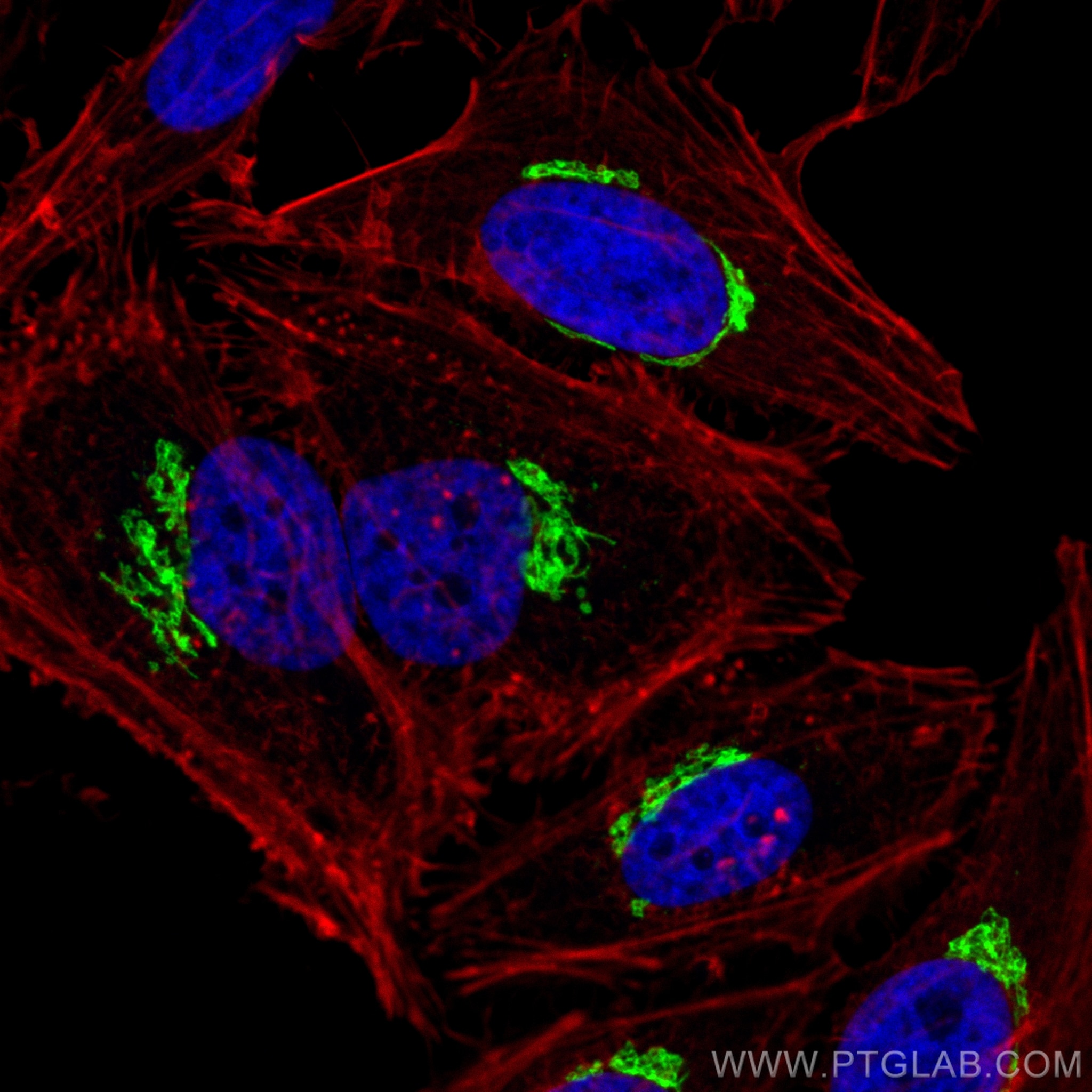 Immunofluorescence (IF) / fluorescent staining of HeLa cells using TMEM165 Polyclonal antibody (20485-1-AP)