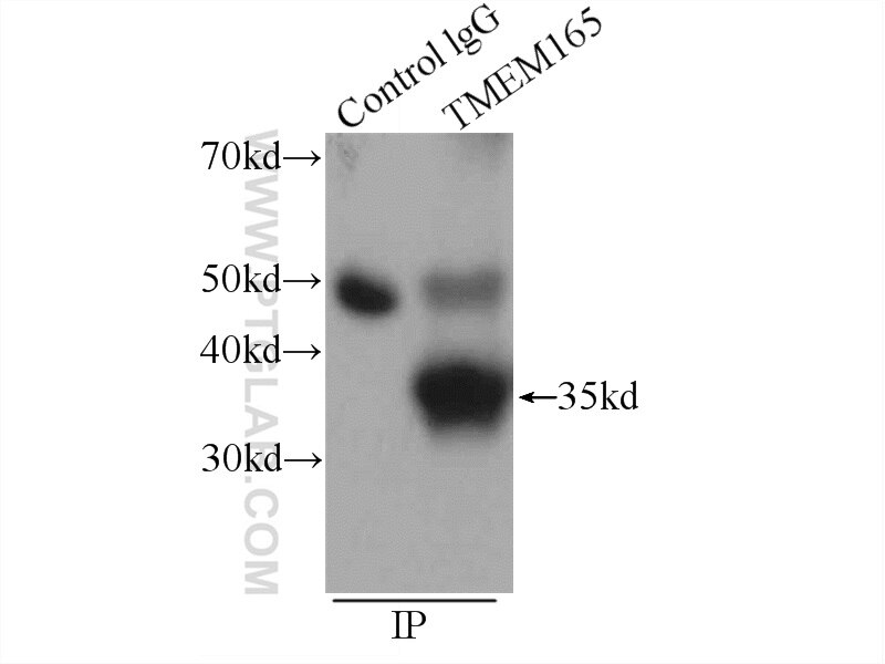 Immunoprecipitation (IP) experiment of HeLa cells using TMEM165 Polyclonal antibody (20485-1-AP)