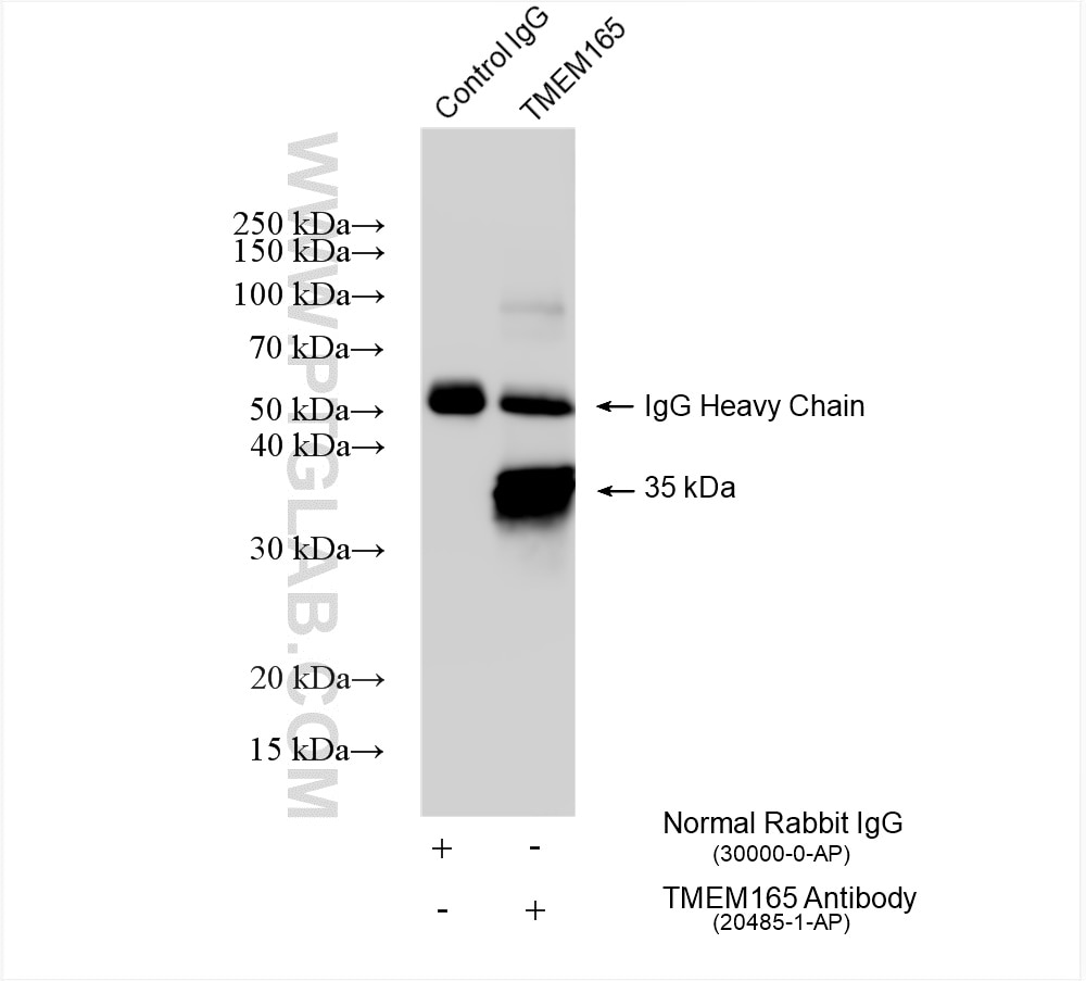 Immunoprecipitation (IP) experiment of HeLa cells using TMEM165 Polyclonal antibody (20485-1-AP)