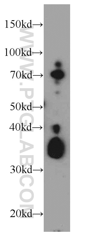 Western Blot (WB) analysis of HeLa cells using TMEM165 Polyclonal antibody (20485-1-AP)