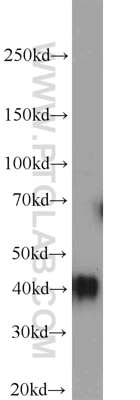 Western Blot (WB) analysis of Jurkat cells using TMEM165 Polyclonal antibody (20485-1-AP)