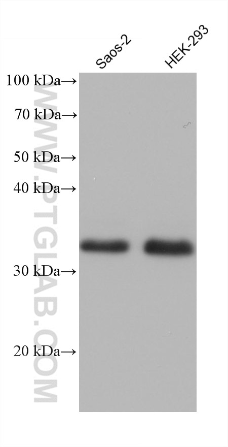 WB analysis using 68584-1-Ig