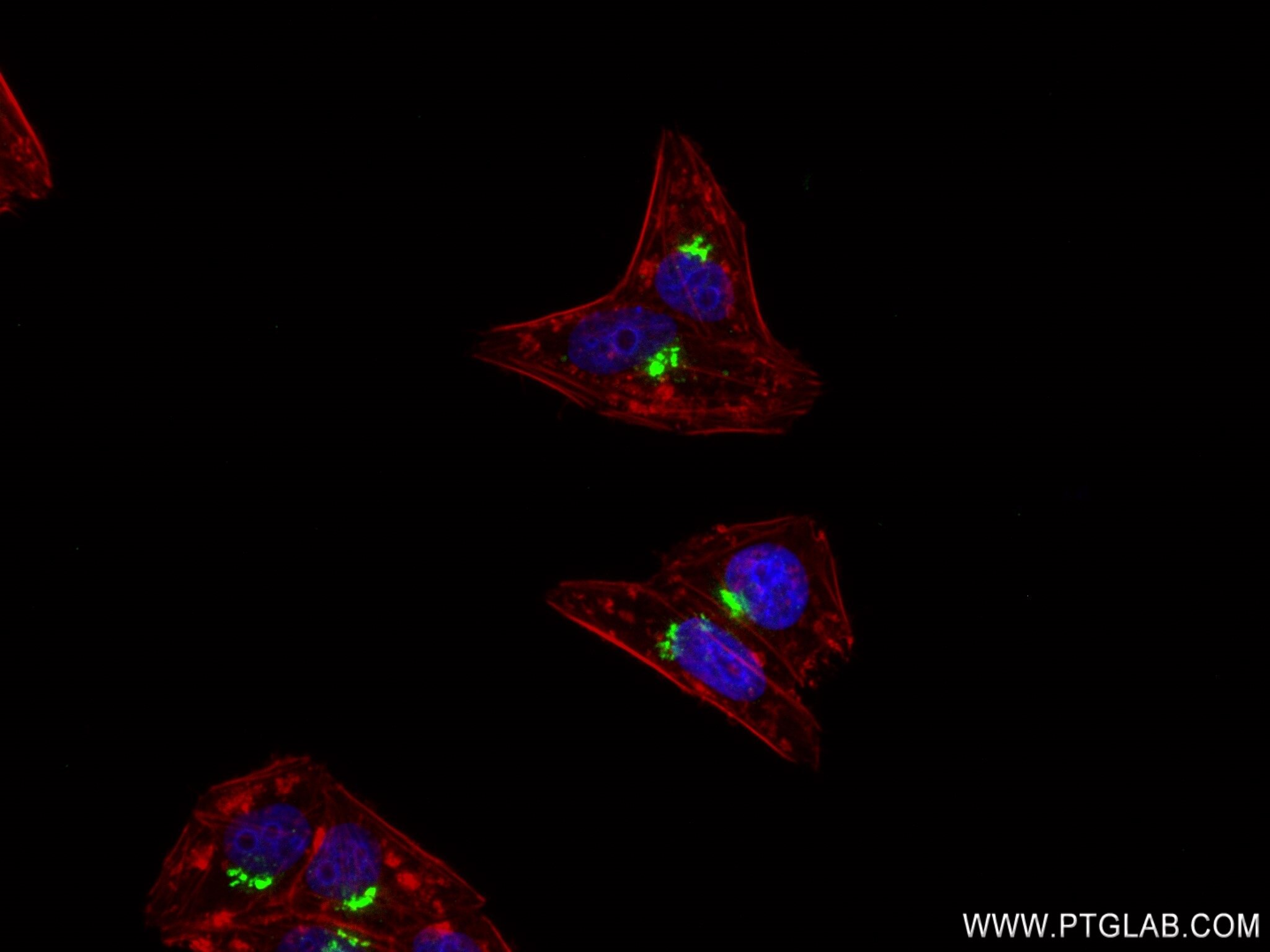 Immunofluorescence (IF) / fluorescent staining of HepG2 cells using TMEM165 Recombinant antibody (83146-1-RR)