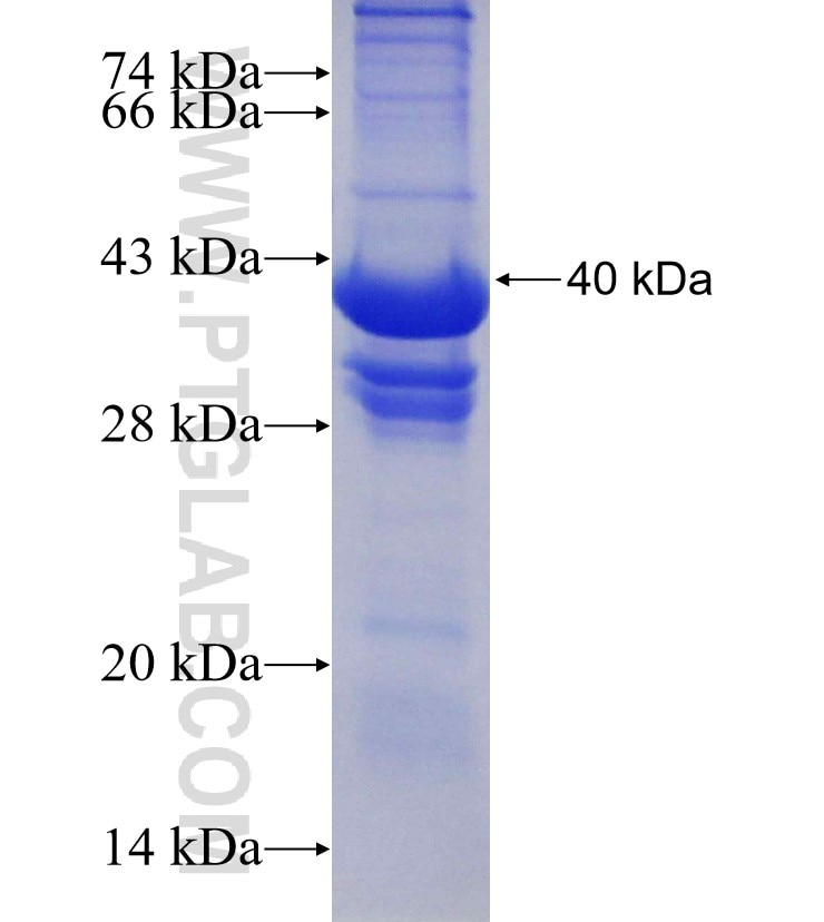 TMEM165 fusion protein Ag14362 SDS-PAGE