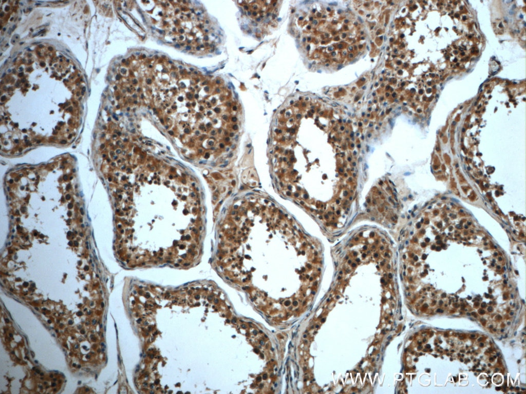 Immunohistochemistry (IHC) staining of human testis tissue using TMEM168 Polyclonal antibody (22527-1-AP)