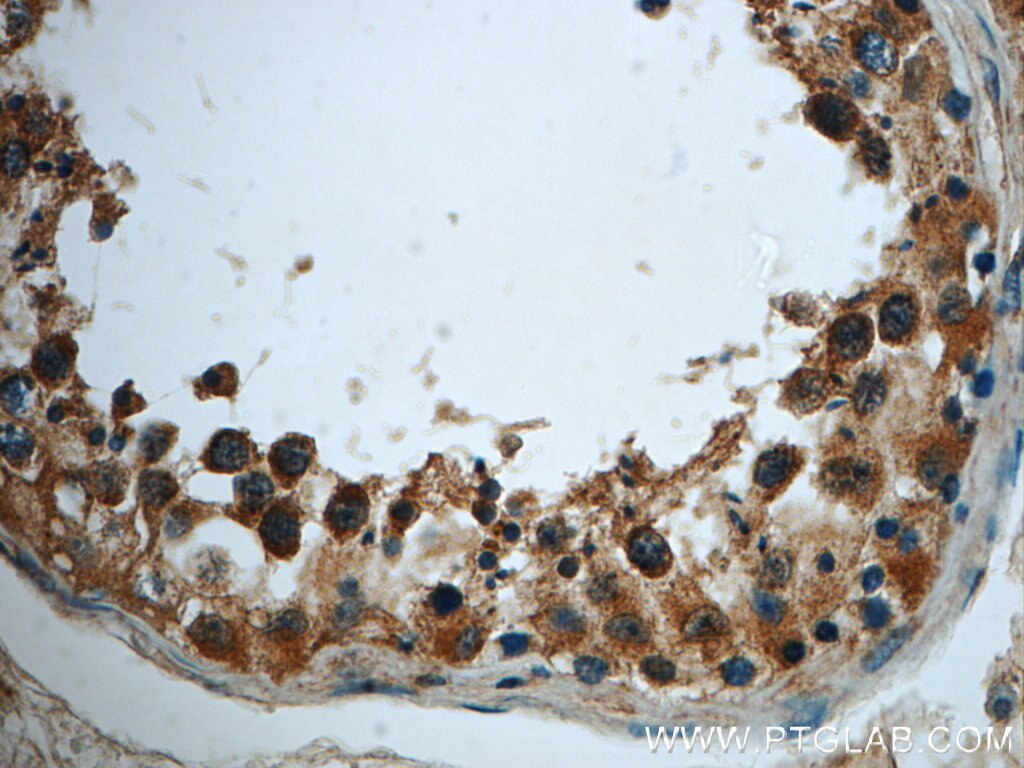 Immunohistochemistry (IHC) staining of human testis tissue using TMEM168 Polyclonal antibody (22527-1-AP)