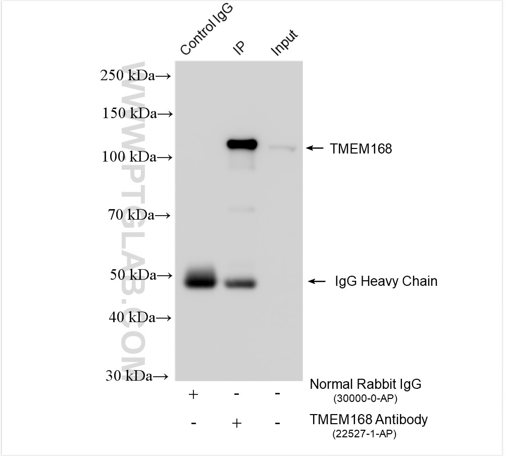 Immunoprecipitation (IP) experiment of mouse brain tissue using TMEM168 Polyclonal antibody (22527-1-AP)