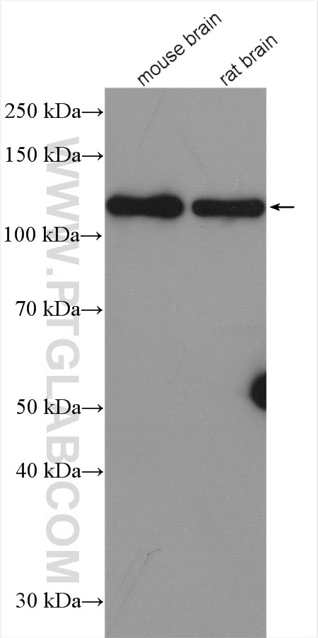 Western Blot (WB) analysis of various lysates using TMEM168 Polyclonal antibody (22527-1-AP)
