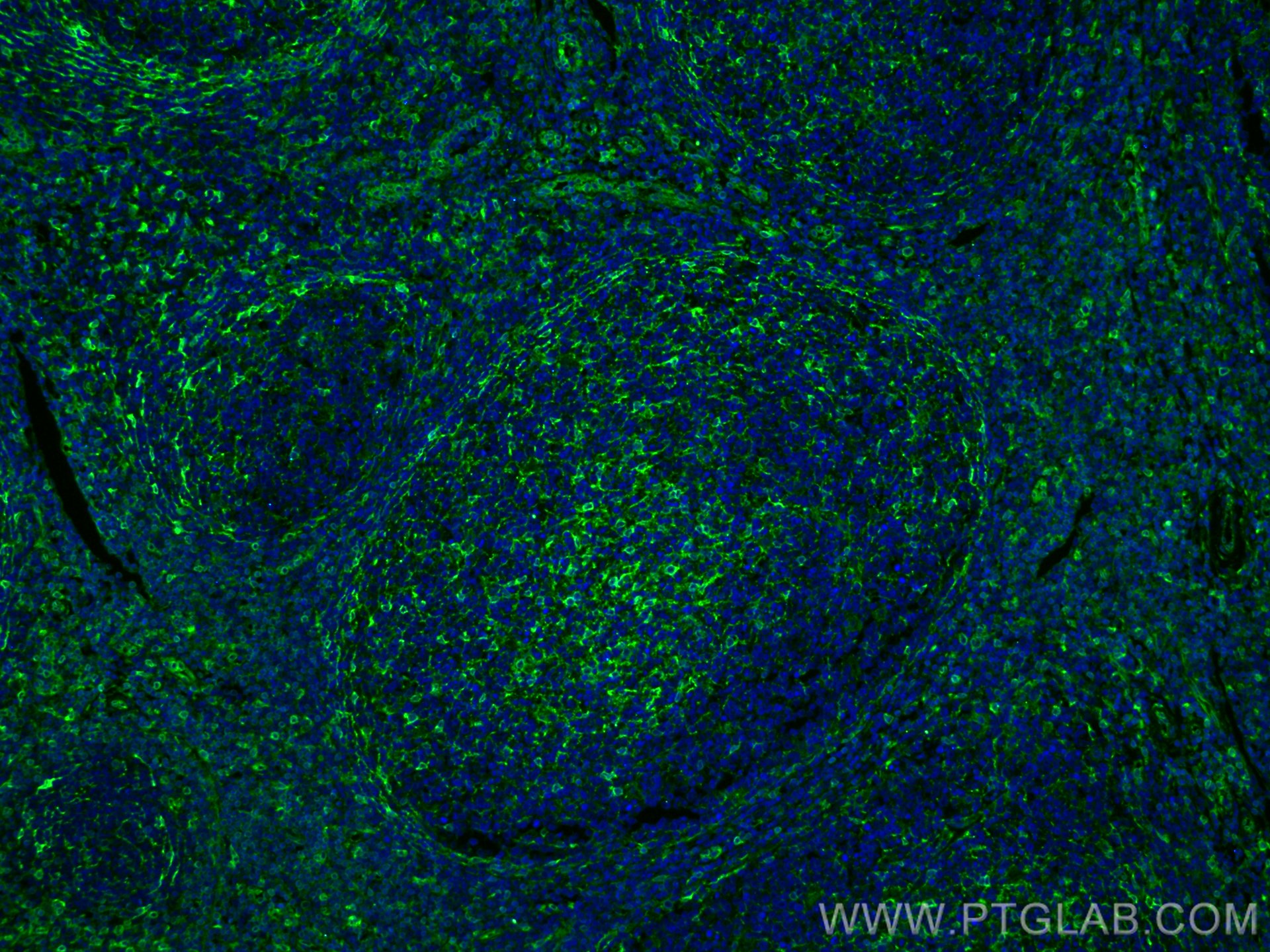 Immunofluorescence (IF) / fluorescent staining of human tonsillitis tissue using TMEM173/STING Polyclonal antibody (19851-1-AP)