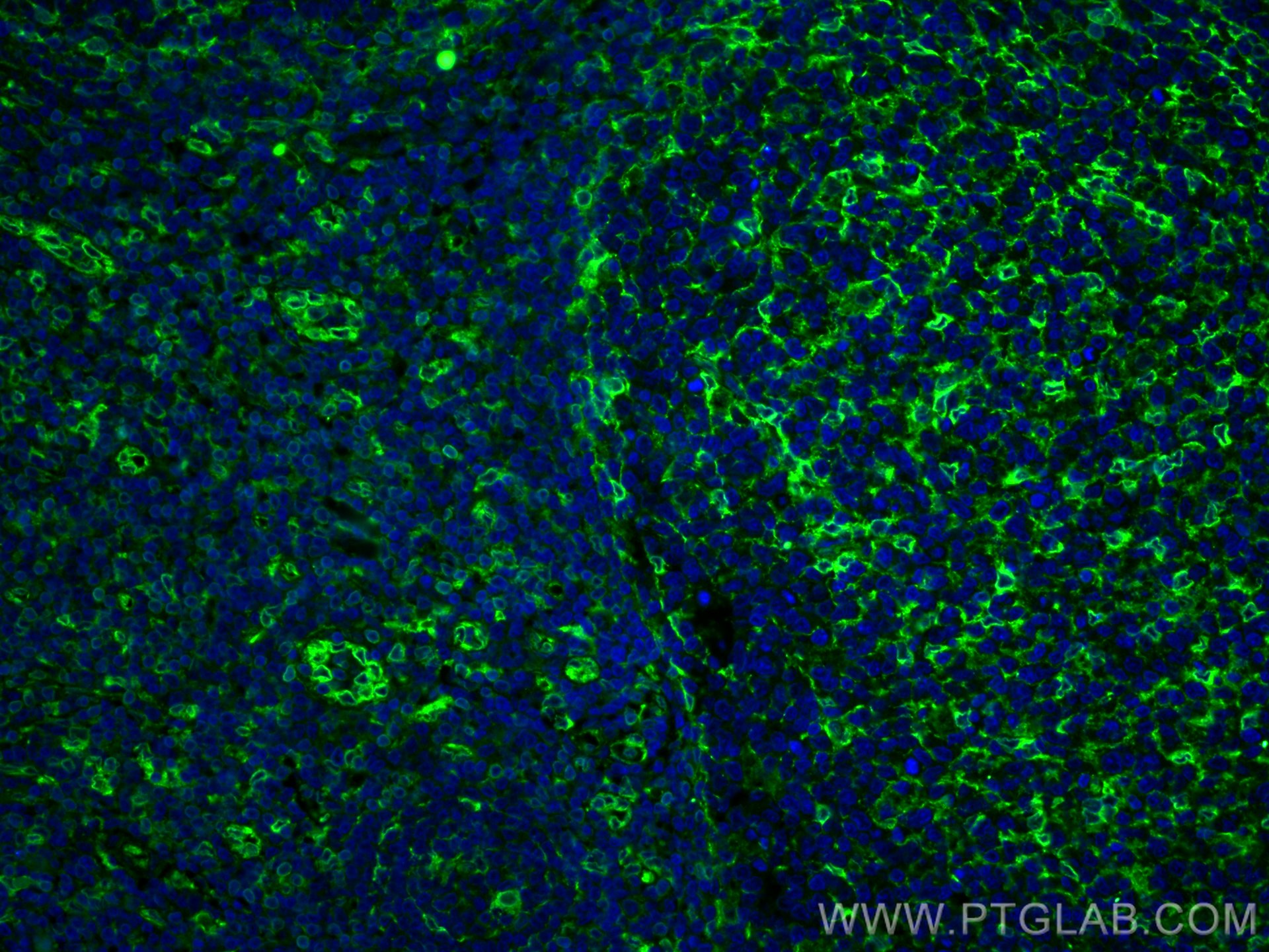 Immunofluorescence (IF) / fluorescent staining of human tonsillitis tissue using TMEM173/STING Polyclonal antibody (19851-1-AP)