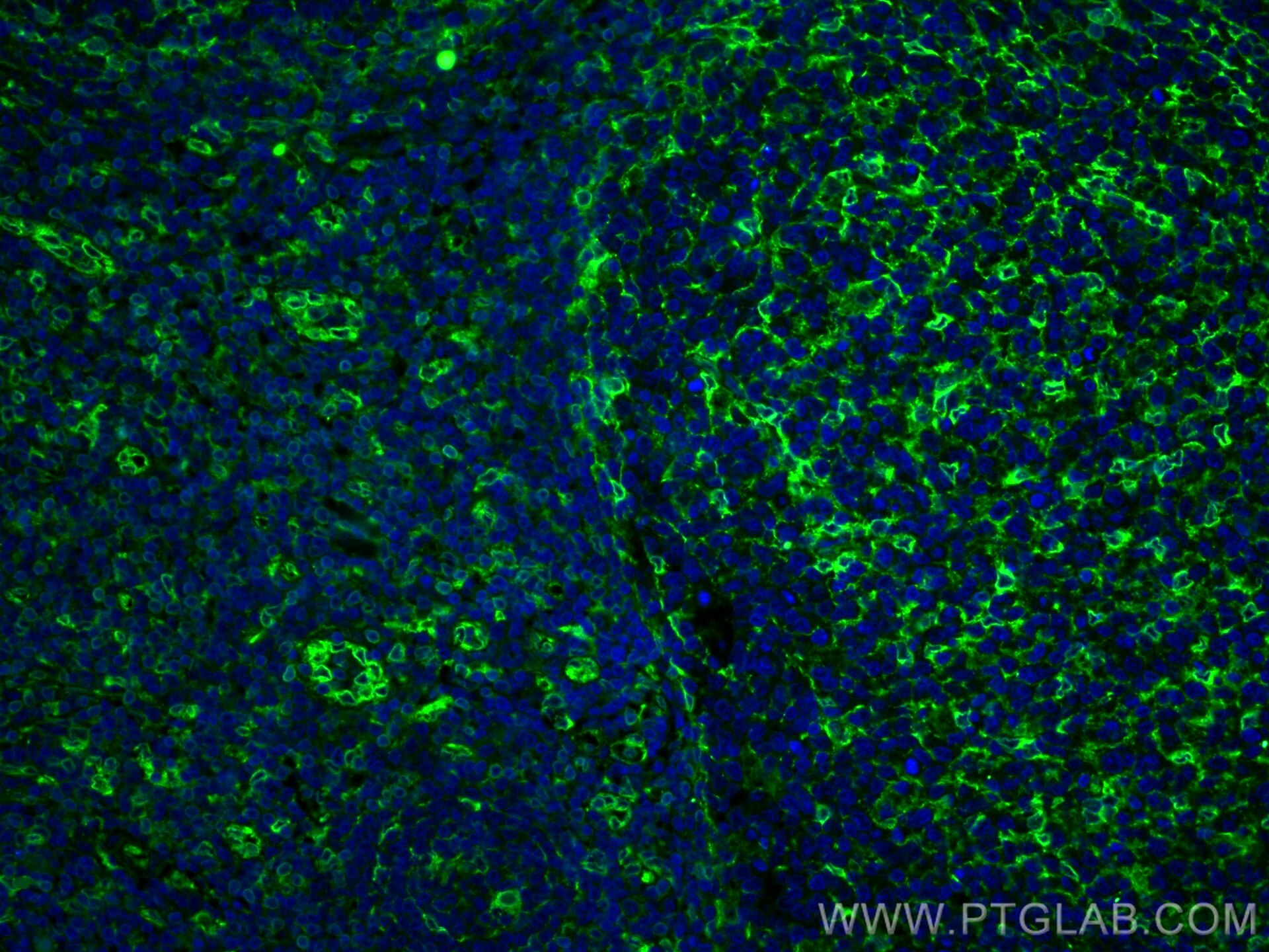 IF Staining of human tonsillitis using 19851-1-AP