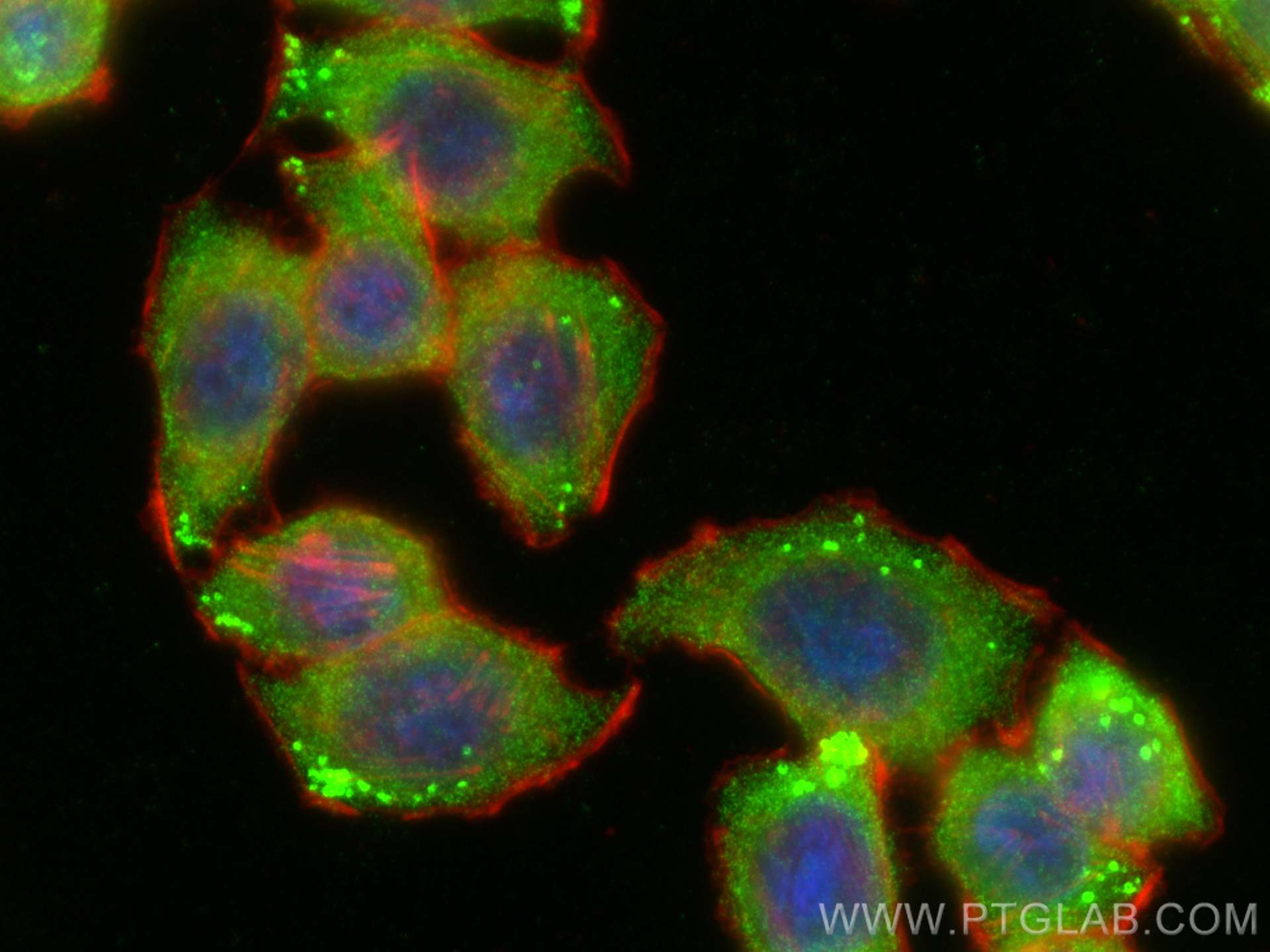 Immunofluorescence (IF) / fluorescent staining of HT-29 cells using TMEM173/STING Polyclonal antibody (19851-1-AP)