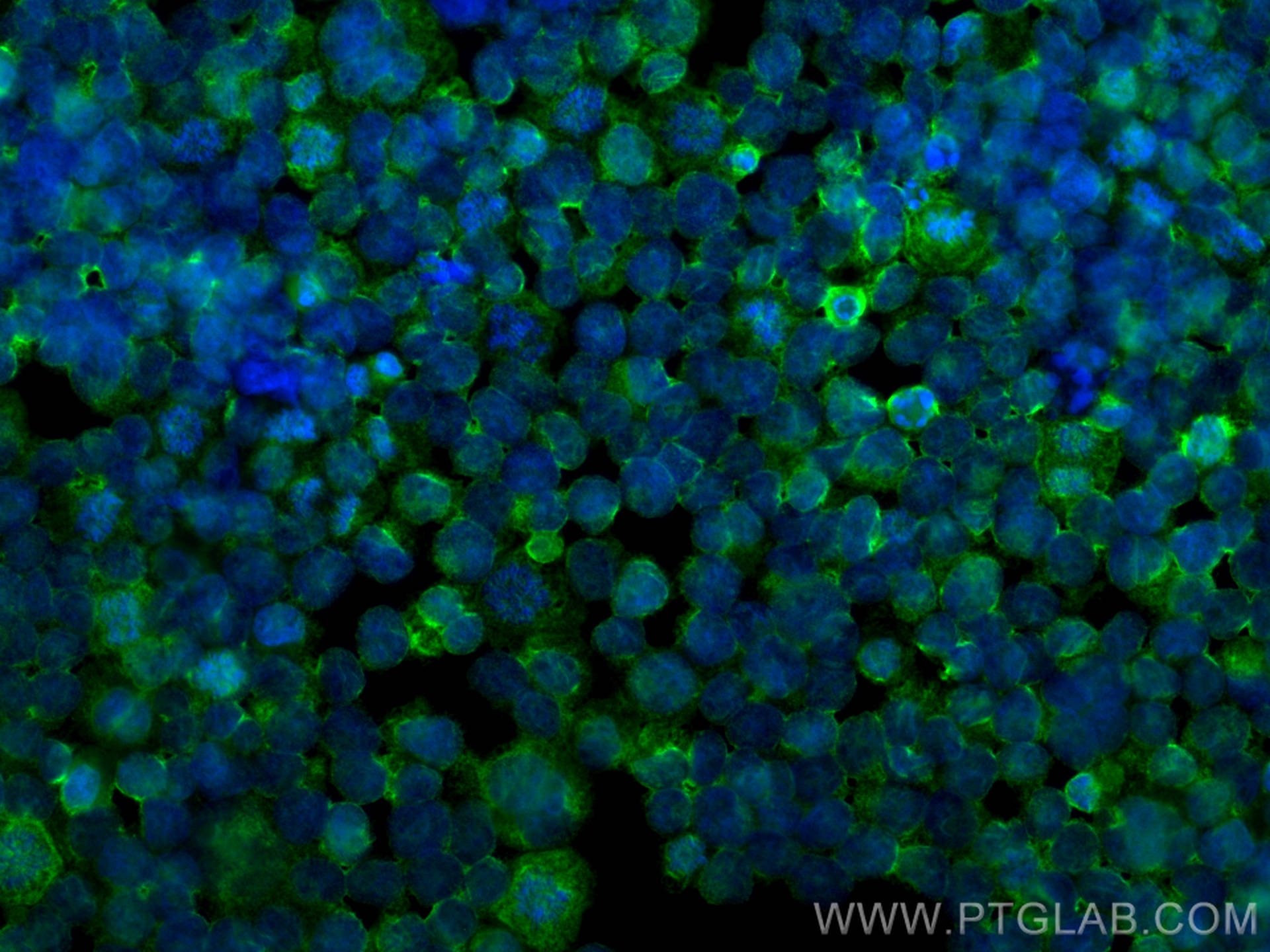 Immunofluorescence (IF) / fluorescent staining of THP-1 cells using TMEM173/STING Polyclonal antibody (19851-1-AP)