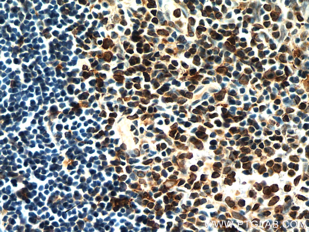 Immunohistochemistry (IHC) staining of rat thymus tissue using TMEM173/STING Polyclonal antibody (19851-1-AP)