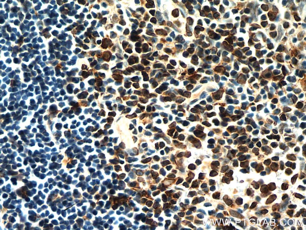 IHC staining of rat thymus using 19851-1-AP