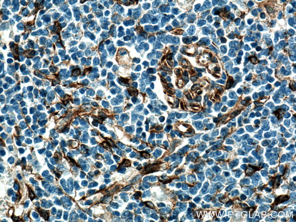 Immunohistochemistry (IHC) staining of human spleen tissue using TMEM173/STING Polyclonal antibody (19851-1-AP)