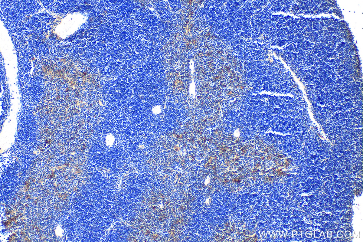 Immunohistochemistry (IHC) staining of mouse thymus tissue using TMEM173/STING Polyclonal antibody (19851-1-AP)