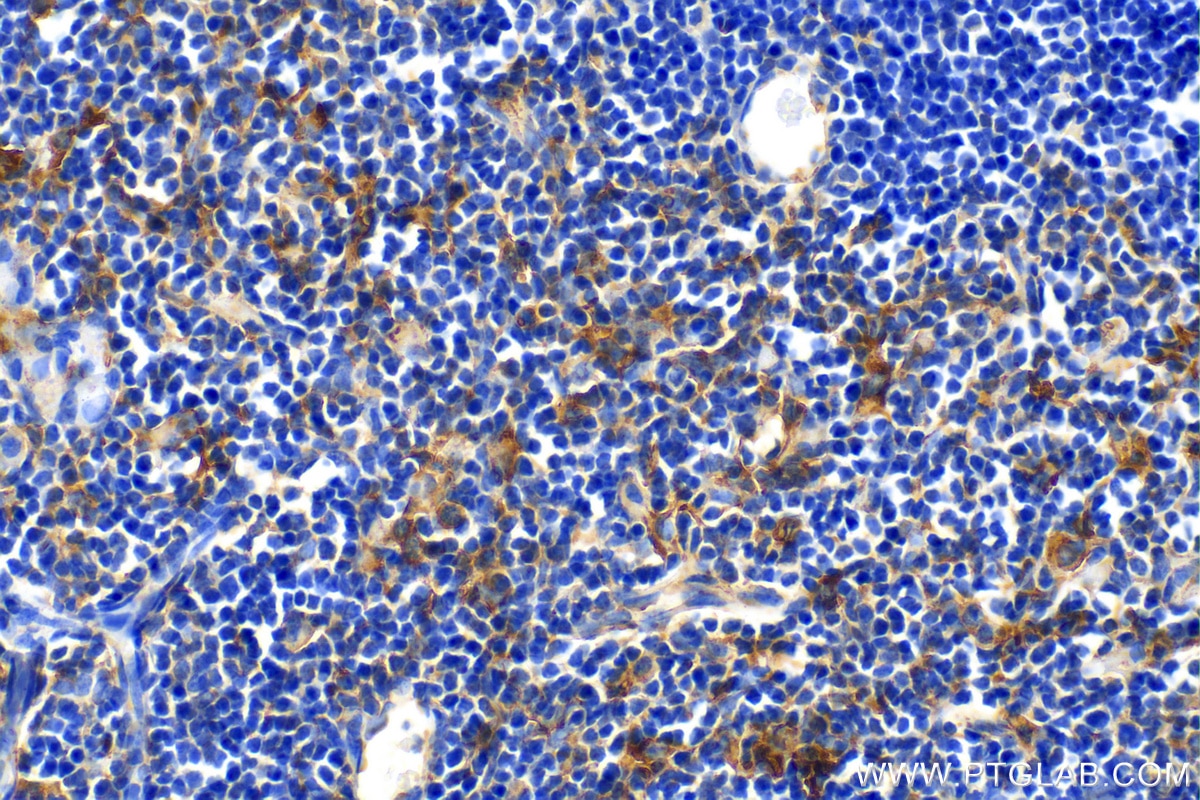 Immunohistochemistry (IHC) staining of mouse thymus tissue using TMEM173/STING Polyclonal antibody (19851-1-AP)