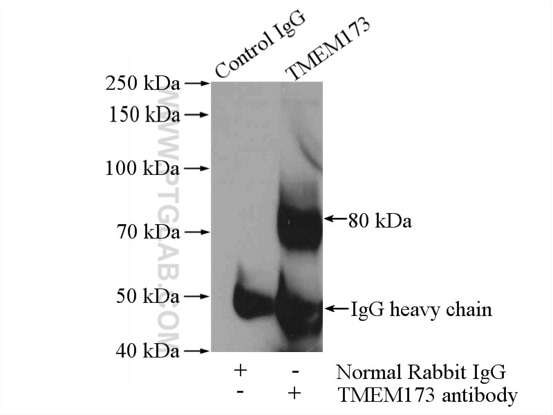 Immunoprecipitation (IP) experiment of mouse spleen tissue using TMEM173/STING Polyclonal antibody (19851-1-AP)