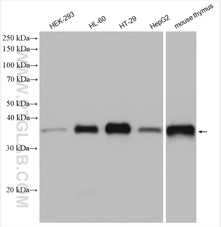 Western Blot (WB) analysis of various lysates using TMEM173/STING Polyclonal antibody (19851-1-AP)