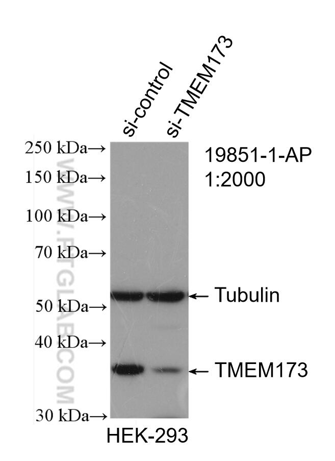 Western Blot (WB) analysis of HEK-293 cells using TMEM173/STING Polyclonal antibody (19851-1-AP)