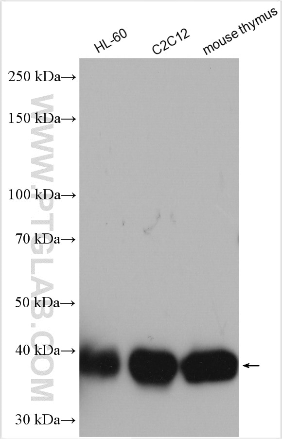 Western Blot (WB) analysis of various lysates using TMEM173/STING Polyclonal antibody (19851-1-AP)