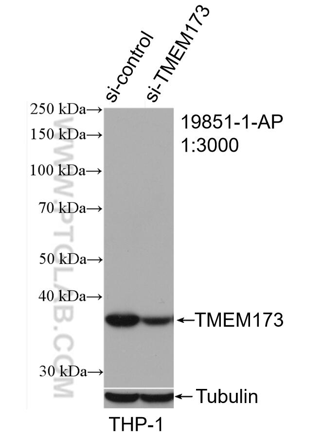 Western Blot (WB) analysis of THP-1 cells using TMEM173/STING Polyclonal antibody (19851-1-AP)
