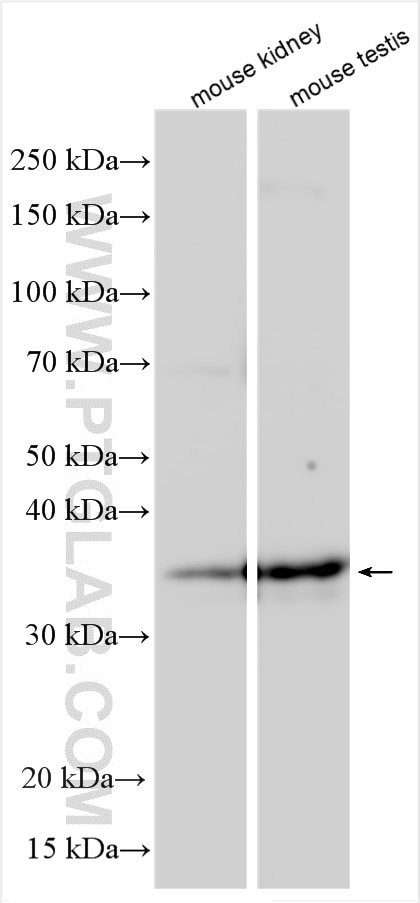 Western Blot (WB) analysis of various lysates using TMEM173/STING Polyclonal antibody (19851-1-AP)