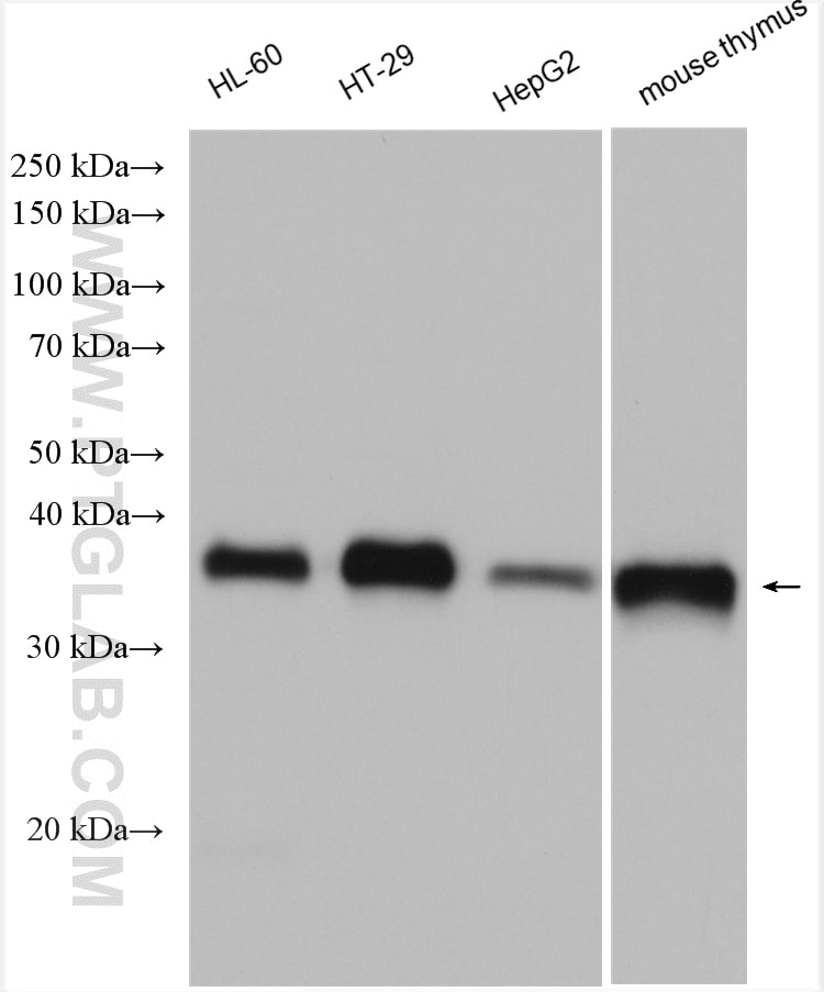 Western Blot (WB) analysis of HL-60 cells using TMEM173/STING Polyclonal antibody (19851-1-AP)