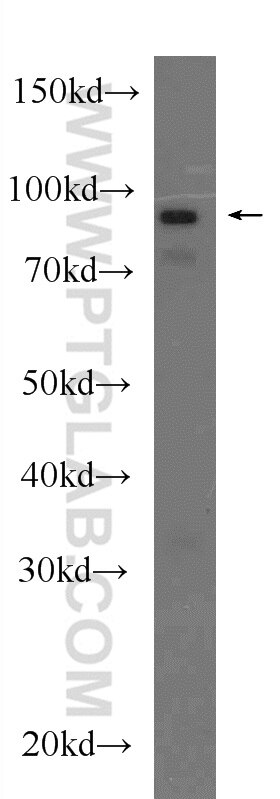 Western Blot (WB) analysis of rat heart tissue using TMEM173/STING Polyclonal antibody (19851-1-AP)