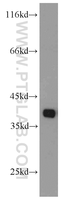 Western Blot (WB) analysis of mouse spleen tissue using TMEM173/STING Polyclonal antibody (19851-1-AP)
