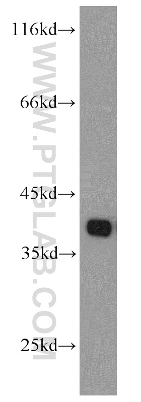 WB analysis of mouse spleen using 19851-1-AP