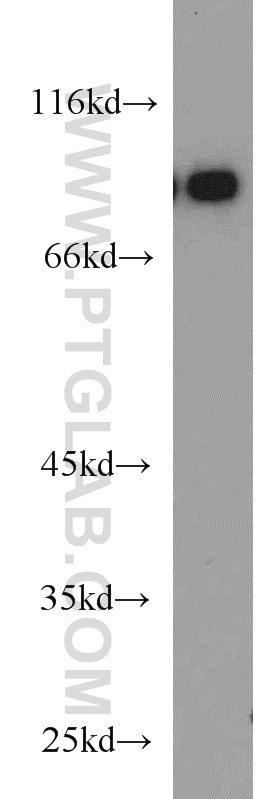 Western Blot (WB) analysis of Raji cells using TMEM173/STING Polyclonal antibody (19851-1-AP)