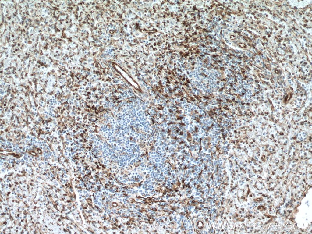 Immunohistochemistry (IHC) staining of human spleen tissue using TMEM173/STING Monoclonal antibody (66680-1-Ig)