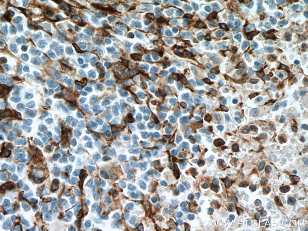 Immunohistochemistry (IHC) staining of human spleen tissue using TMEM173/STING Monoclonal antibody (66680-1-Ig)