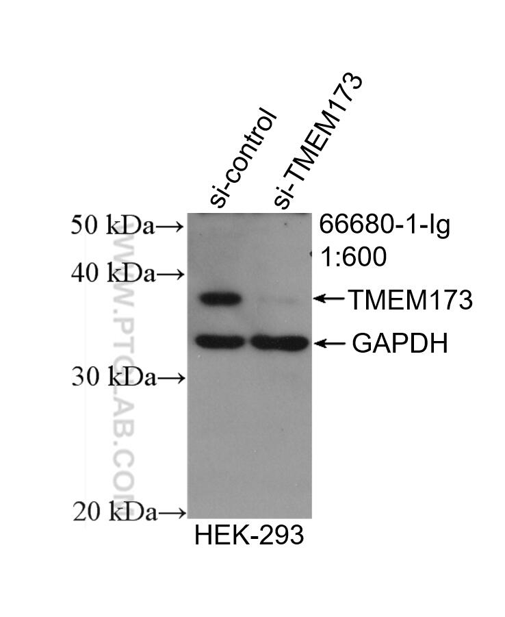 Western Blot (WB) analysis of HEK-293 cells using TMEM173/STING Monoclonal antibody (66680-1-Ig)