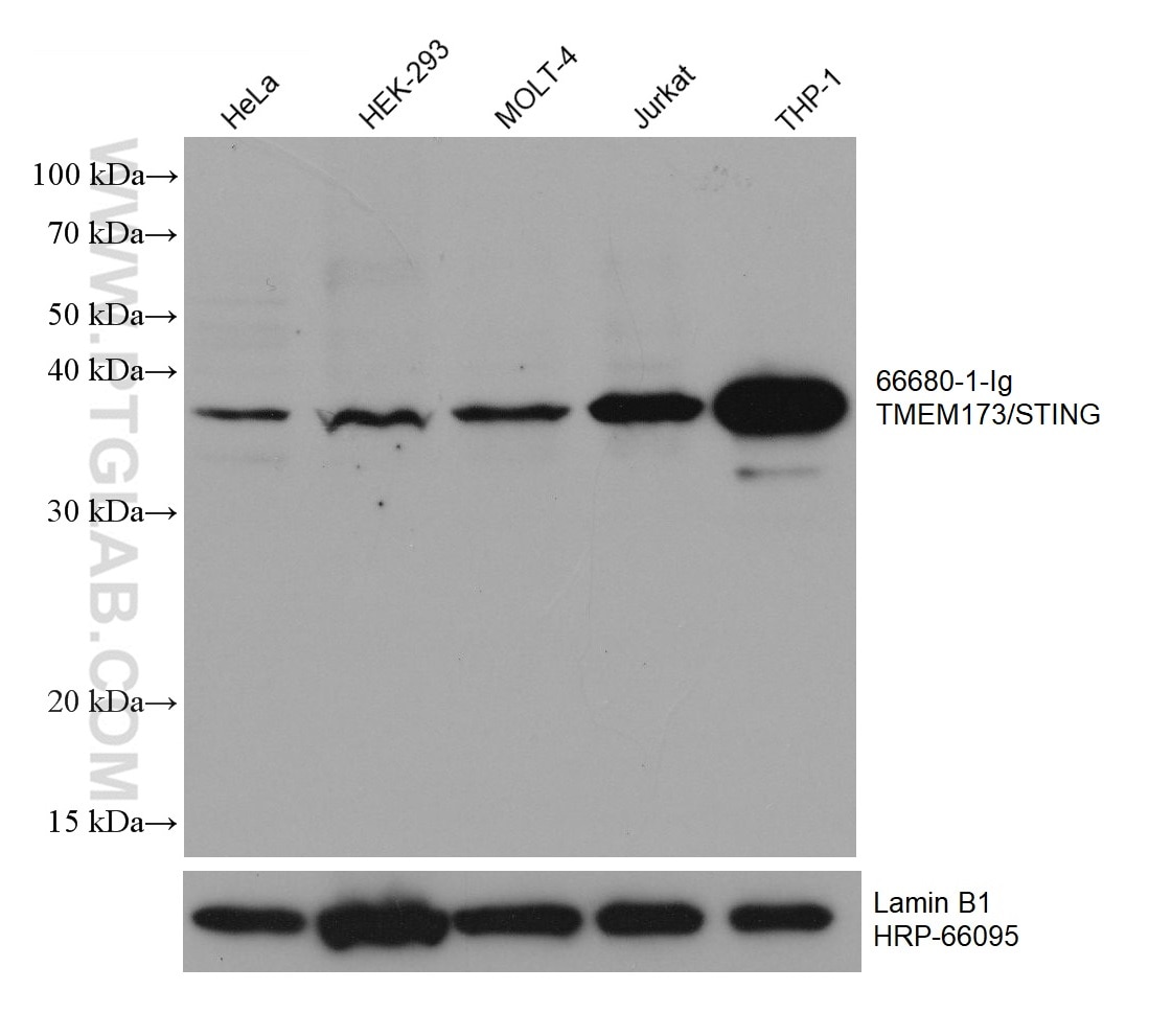 Western Blot (WB) analysis of various lysates using TMEM173/STING Monoclonal antibody (66680-1-Ig)