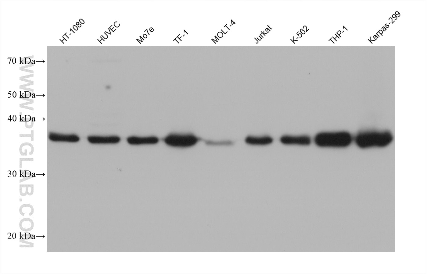 WB analysis using 66680-1-Ig (same clone as 66680-1-PBS) Western Blot (WB) analysis of various lysates using TMEM173/STING Monoclonal antibody (66680-1-Ig)