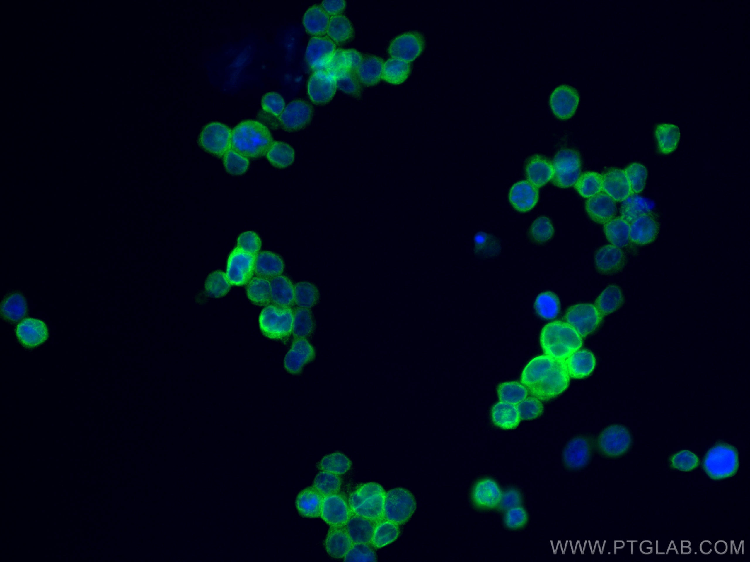 Immunofluorescence (IF) / fluorescent staining of THP-1 cells using TMEM173/STING Recombinant antibody (80165-1-RR)