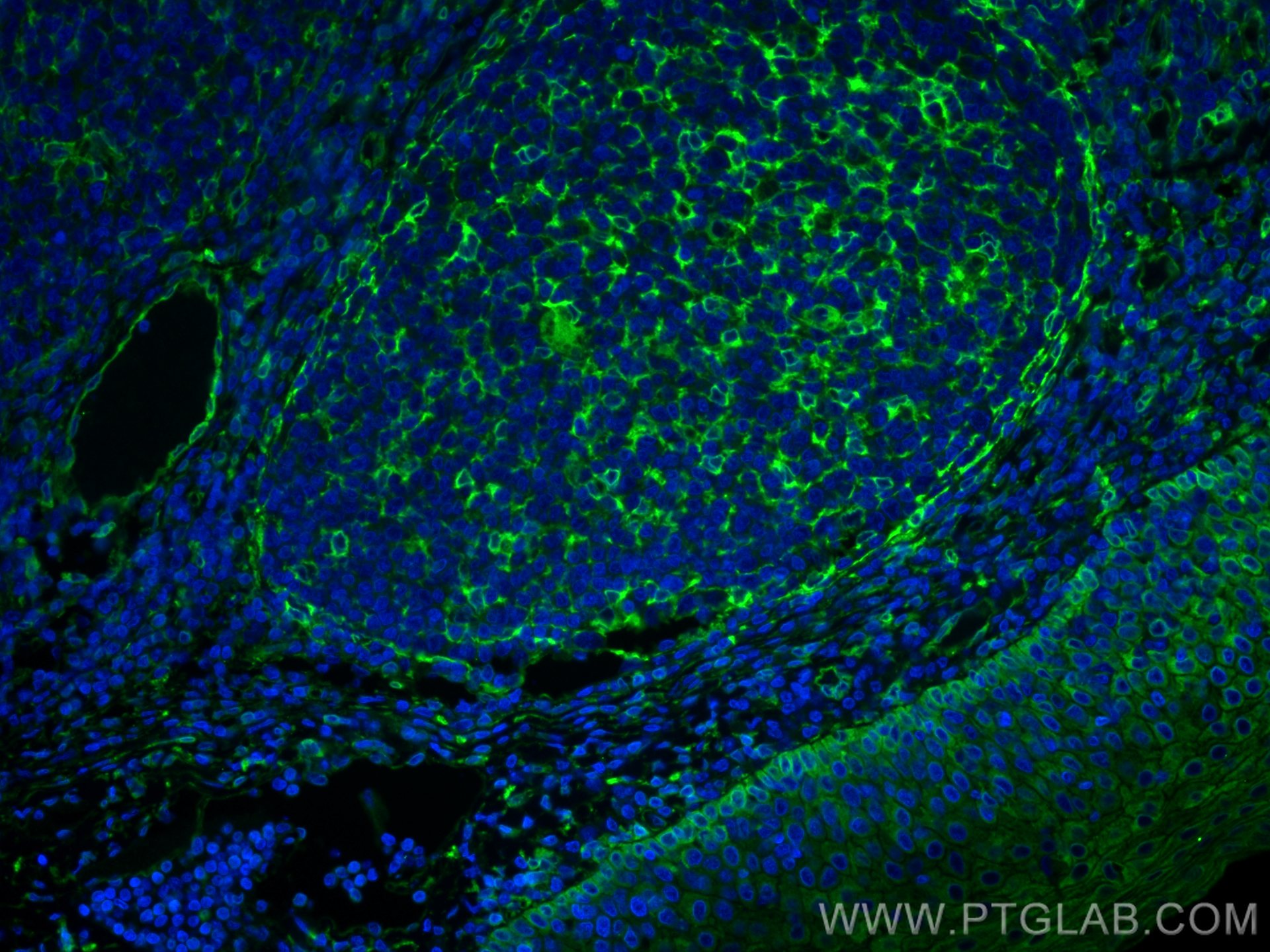 IF Staining of human tonsillitis using 80165-1-RR