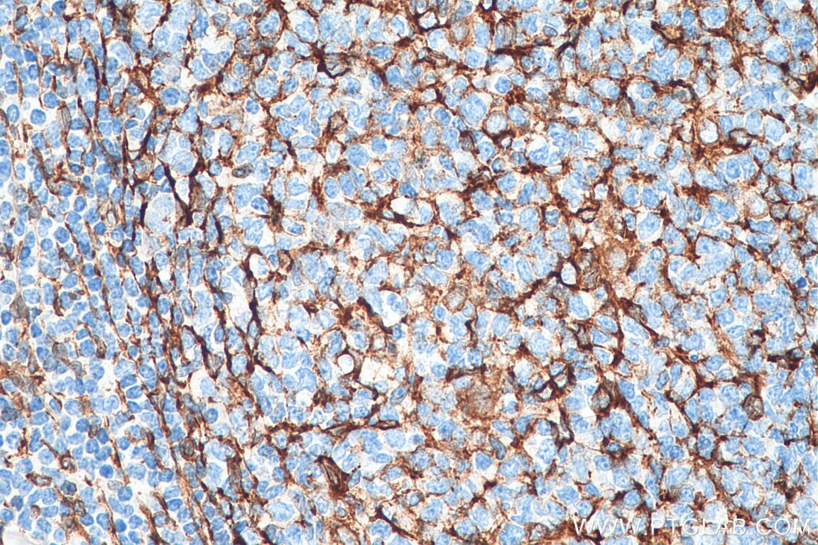 Immunohistochemistry (IHC) staining of human tonsillitis tissue using TMEM173/STING Recombinant antibody (80165-1-RR)