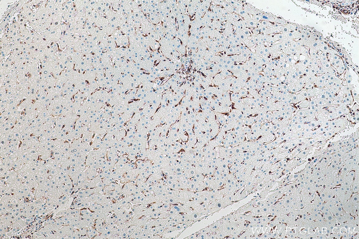 IHC staining of human liver using 80165-1-RR