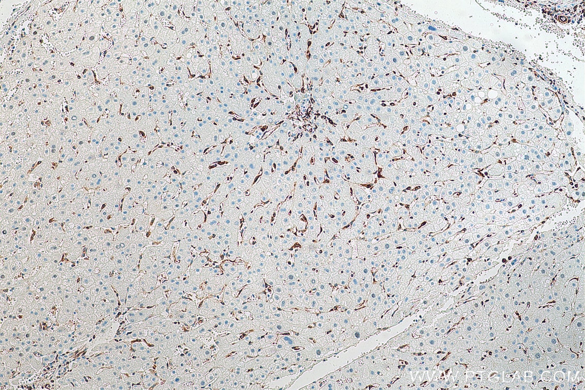 Immunohistochemistry (IHC) staining of human liver tissue using TMEM173/STING Recombinant antibody (80165-1-RR)