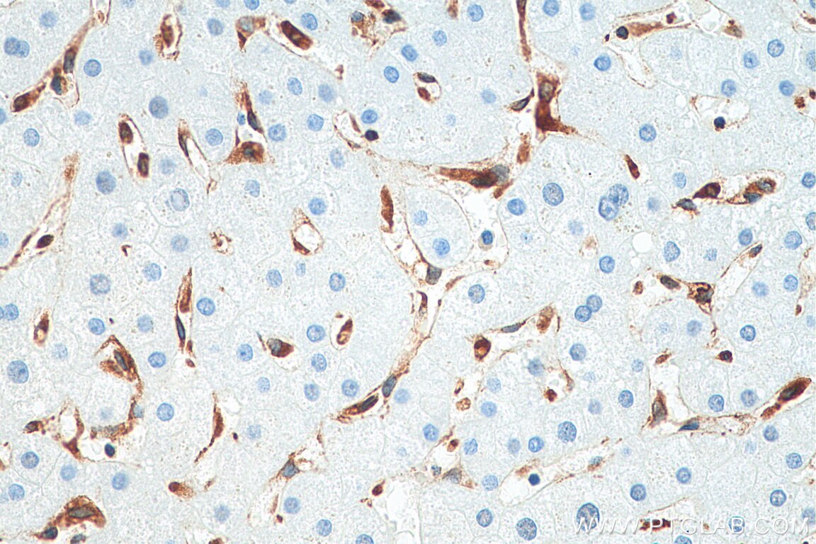 Immunohistochemistry (IHC) staining of human liver tissue using TMEM173/STING Recombinant antibody (80165-1-RR)