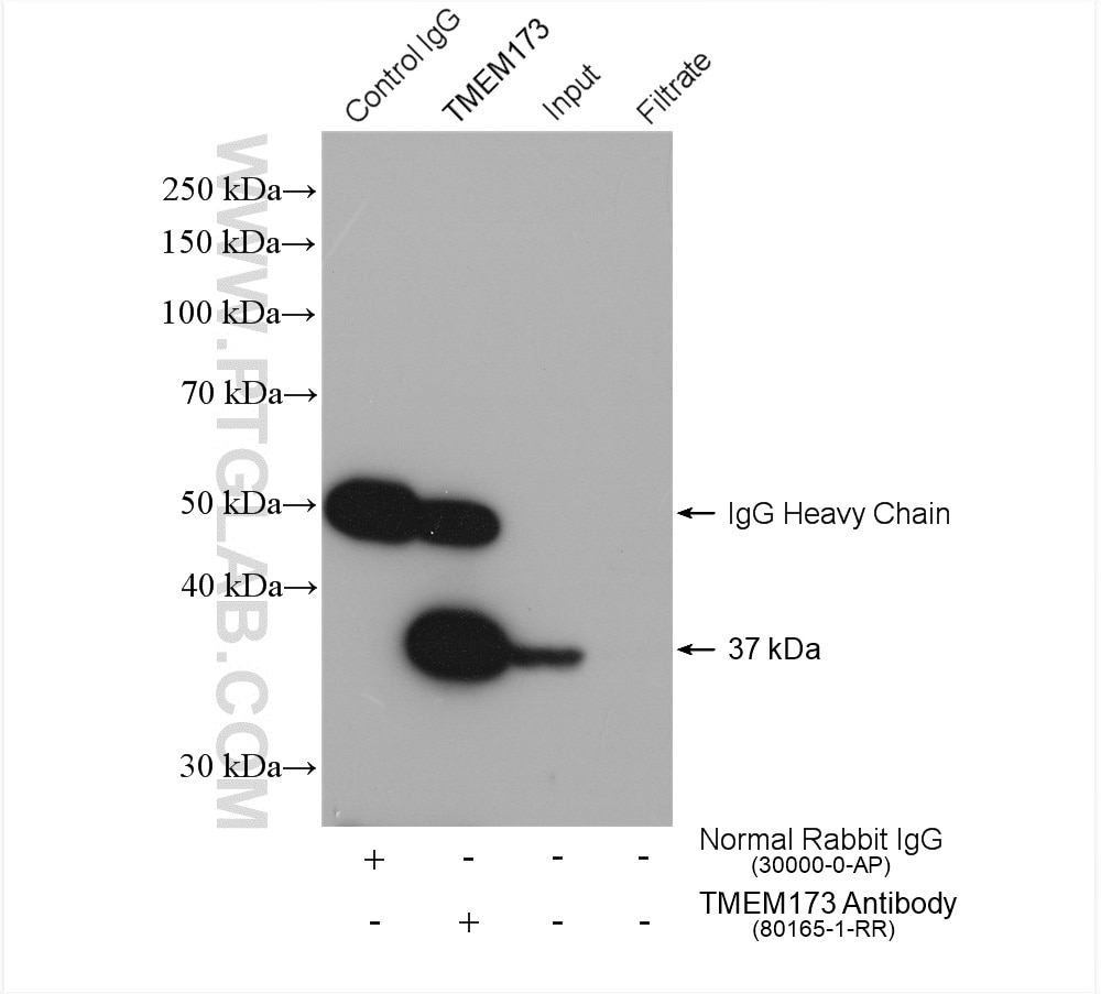 Immunoprecipitation (IP) experiment of HeLa cells using TMEM173/STING Recombinant antibody (80165-1-RR)