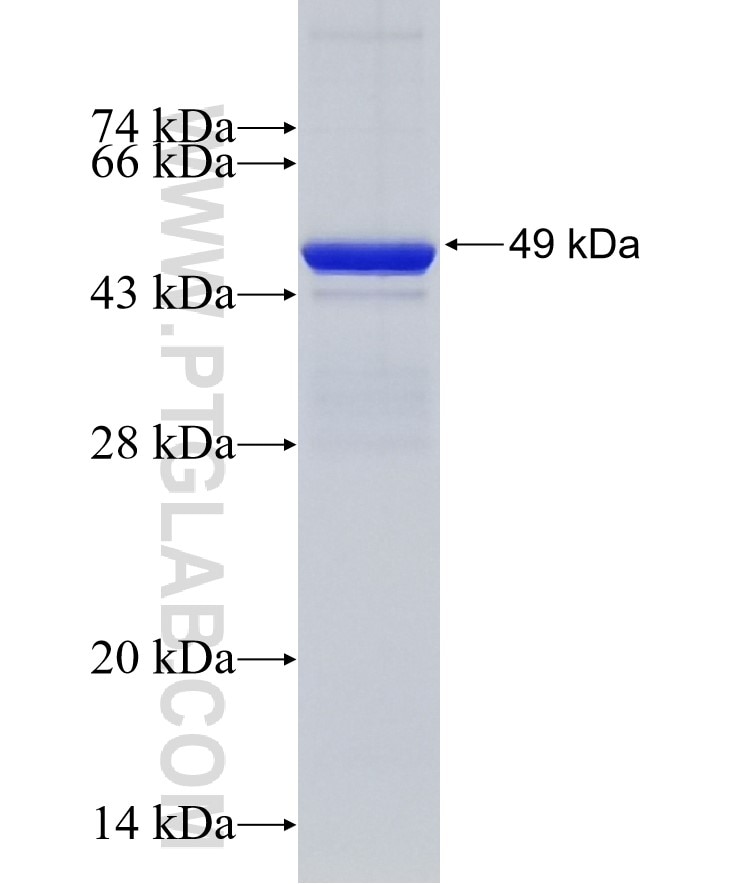 TMEM173 fusion protein Ag13921 SDS-PAGE