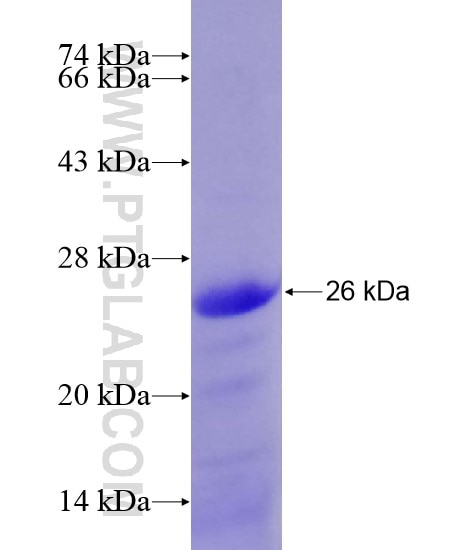 TMEM173 fusion protein Ag20363 SDS-PAGE