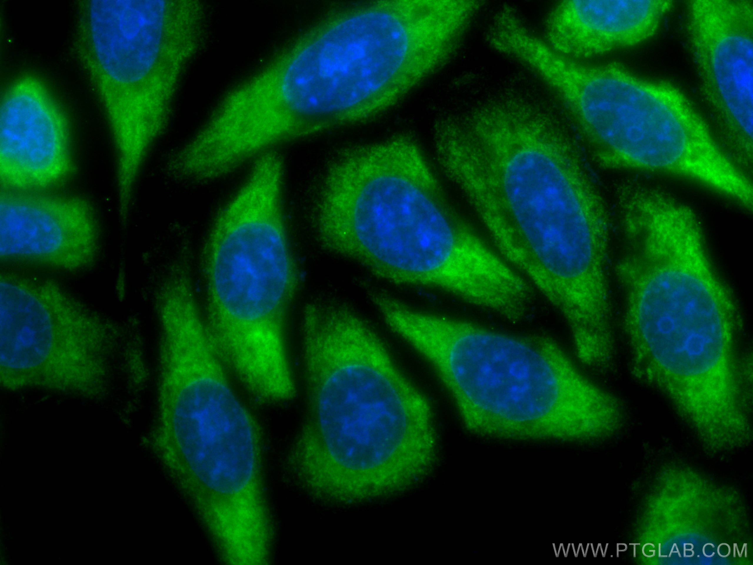 Immunofluorescence (IF) / fluorescent staining of HepG2 cells using CoraLite® Plus 488-conjugated TMEM173/STING Polycl (CL488-19851)