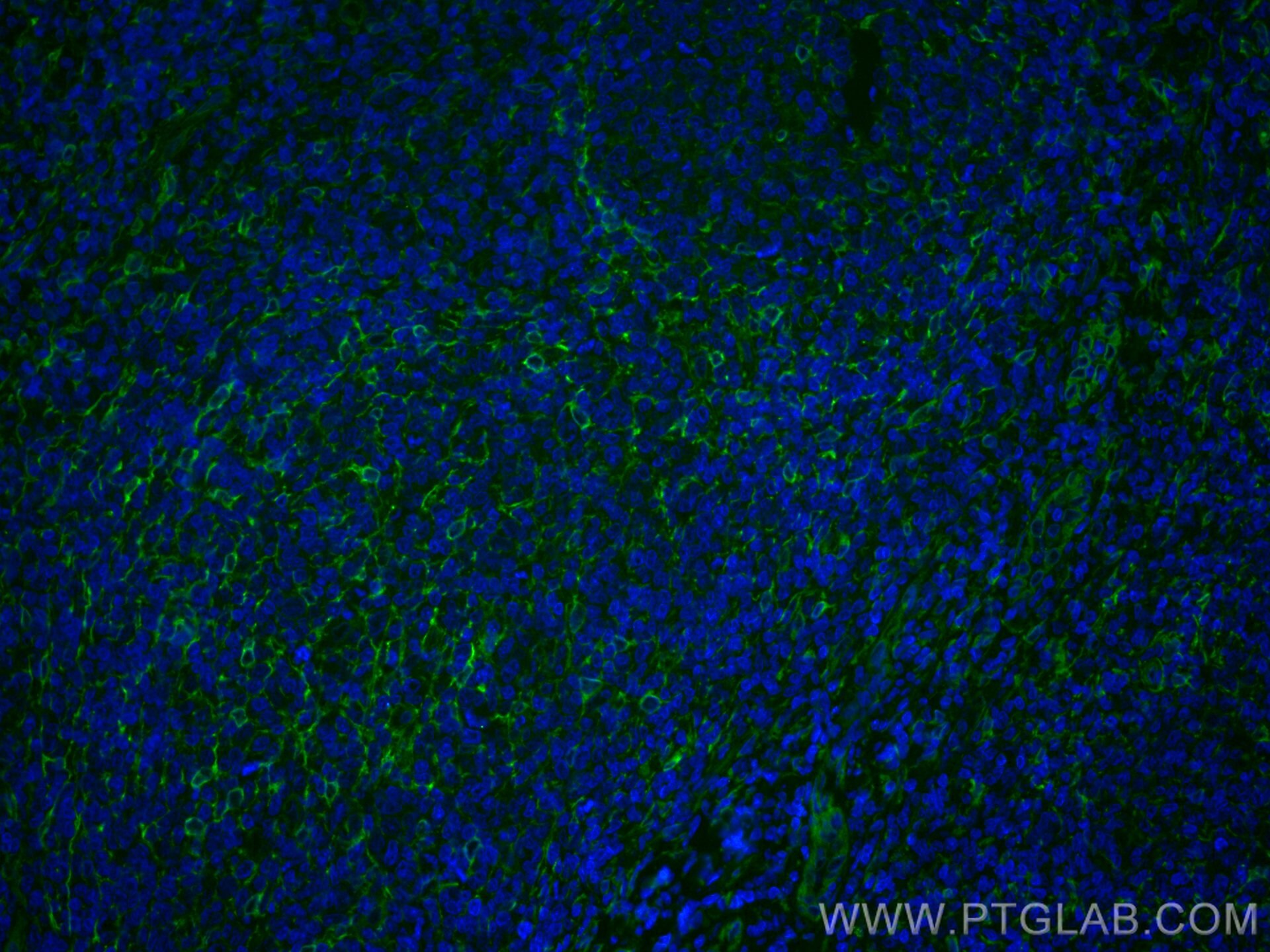 Immunofluorescence (IF) / fluorescent staining of human tonsillitis tissue using CoraLite® Plus 488-conjugated TMEM173/STING Recomb (CL488-80165)